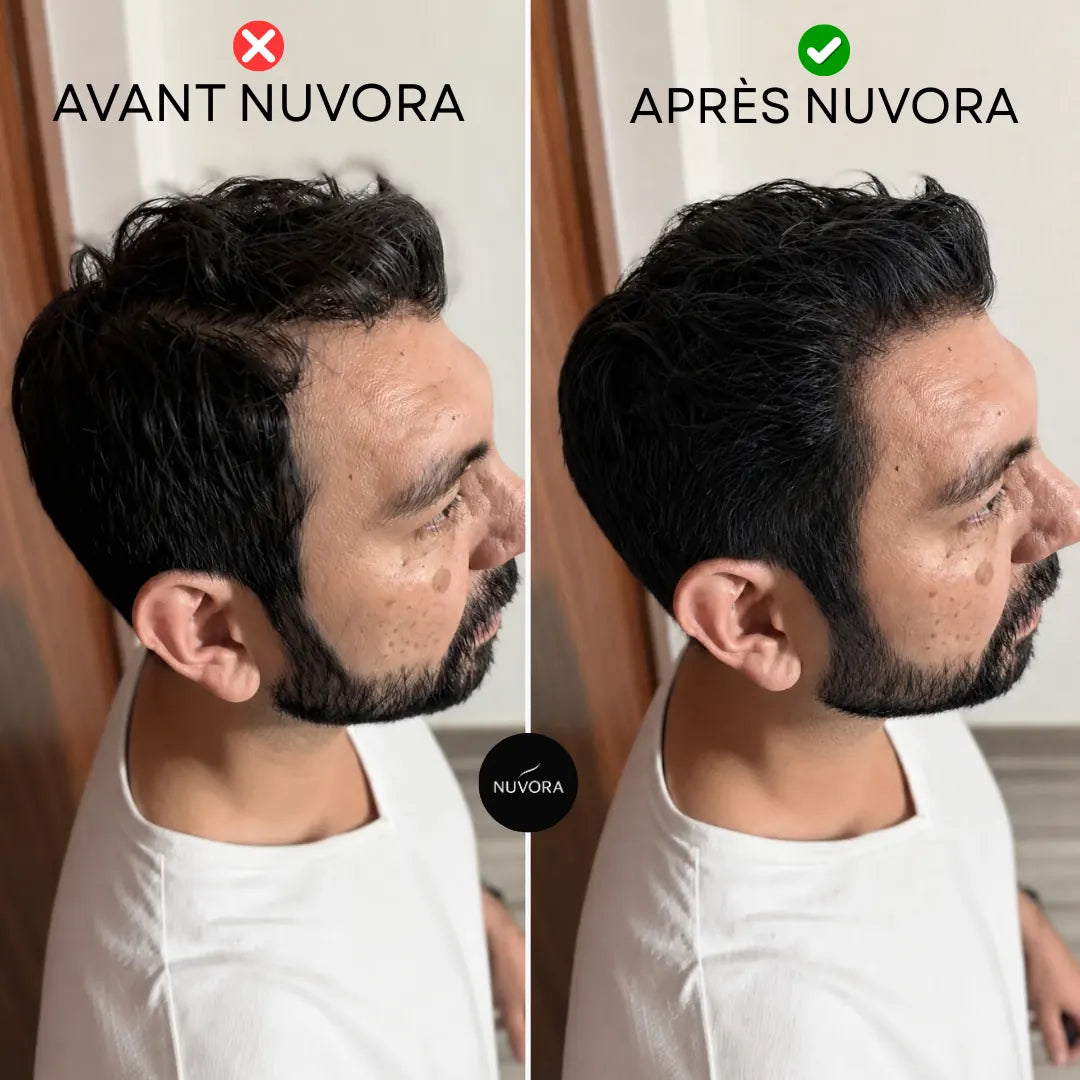 Camouflage Capillaire Homme