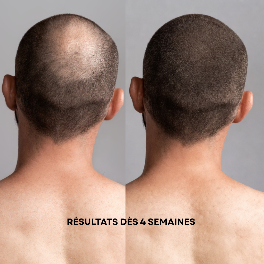 Huile Anti-Chute Cheveux au Ricin, Romarin & Argan - Nuvora